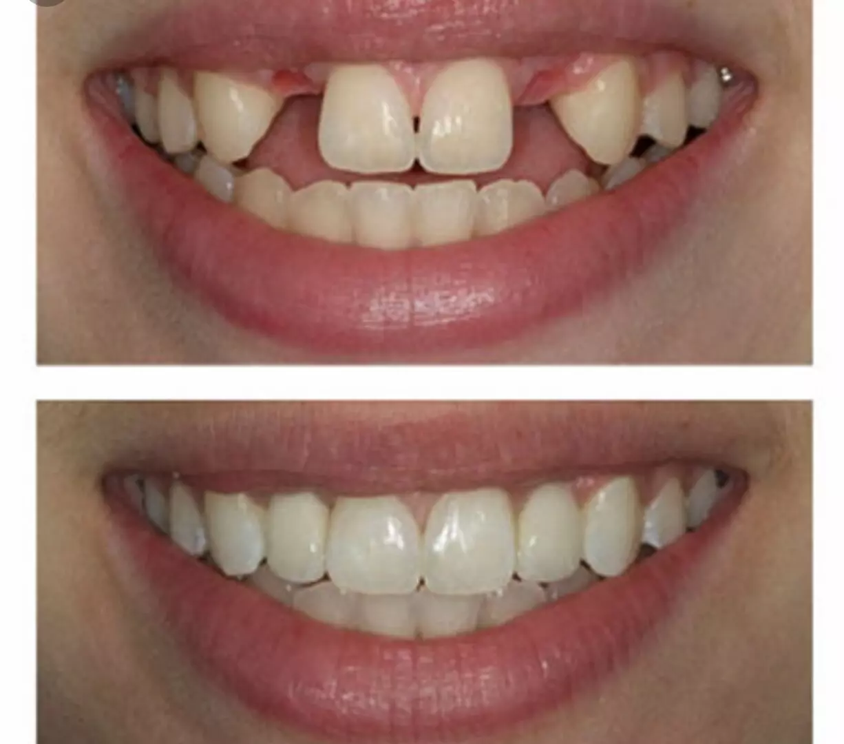 Before and after photos of our dental care services