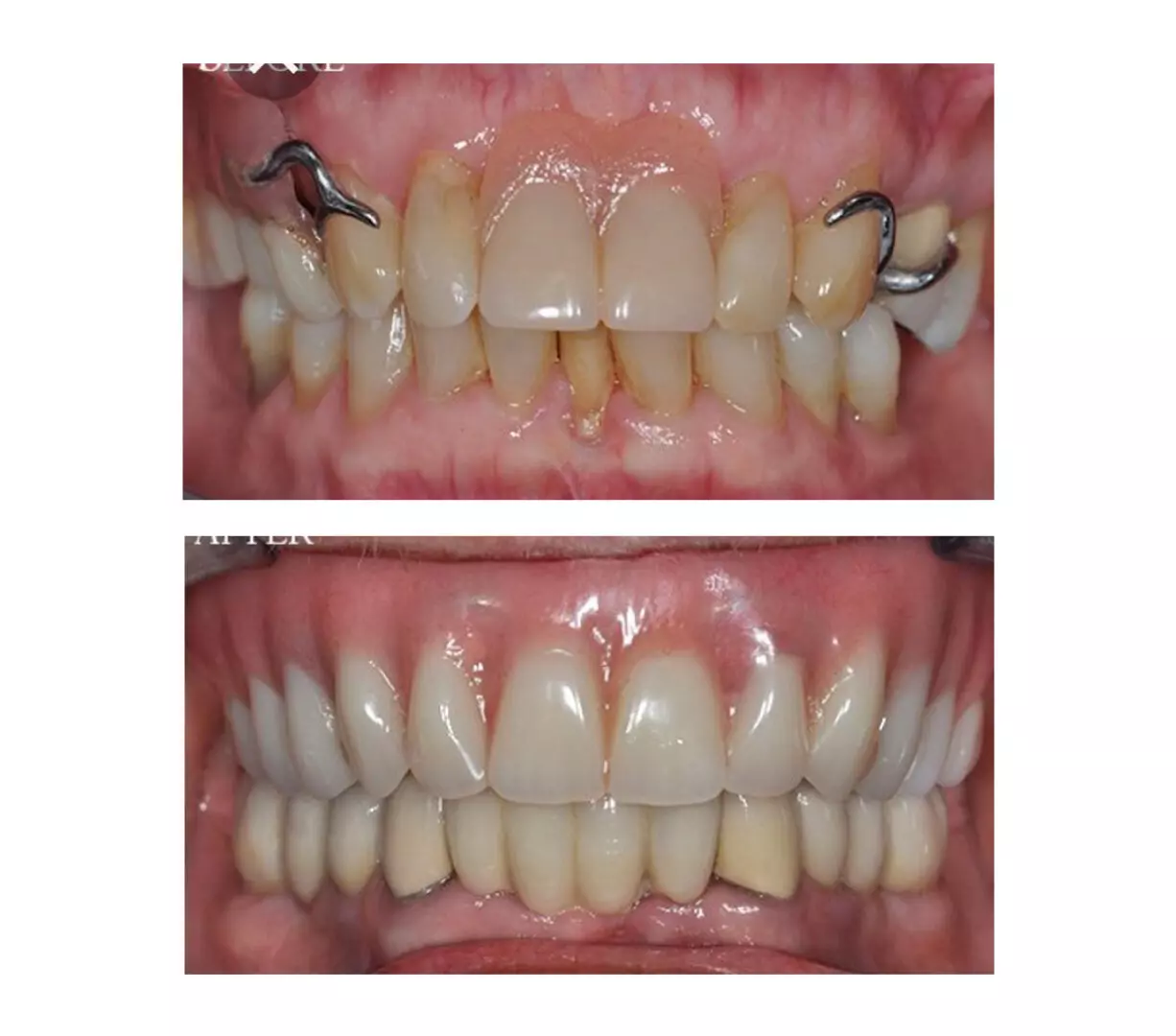 Before and after photos of our dental procedure